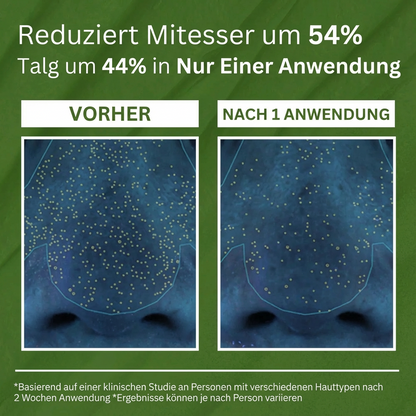 Bubble Holy Basil Mask™